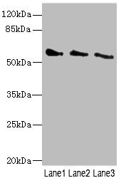 CHRNG Antibody - Western blot All Lanes: CHRNG antibody at 5.5ug/ml Lane 1: 293T whole cell lysate Lane 2: HepG-2 whole cell lysate Lane 3: Hela whole cell lysate Secondary Goat polyclonal to rabbit IgG at 1/10000 dilution Predicted band size: 58,53 kDa Observed band size: 58 kDa