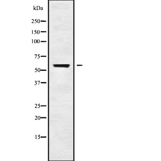 CHRNG Antibody - Western blot analysis of CHRNG using HT29 whole cells lysates