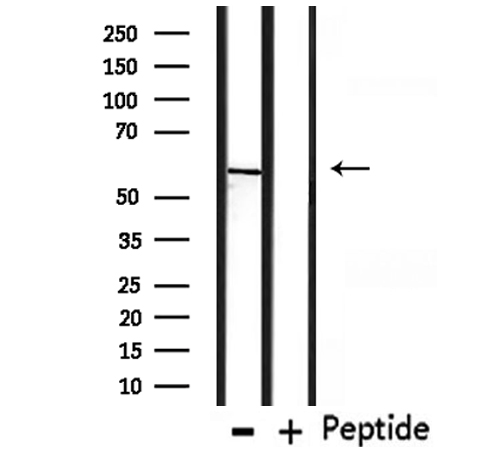 CHRNG Antibody - Western blot analysis of extracts of HepG2 cells using CHRNG antibody.