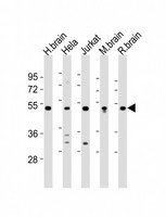 CHST1 Antibody - All lanes : Anti-CHST1 Antibody at 1:2000 dilution Lane 1: human brain lysates Lane 2: HeLa whole cell lysates Lane 3: Jurkat whole cell lysates Lane 4: mouse brain lysates Lane 5: rat brain lysates Lysates/proteins at 20 ug per lane. Secondary Goat Anti-Rabbit IgG, (H+L), Peroxidase conjugated at 1/10000 dilution Predicted band size : 47 kDa Blocking/Dilution buffer: 5% NFDM/TBST.