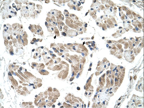 CHST1 Antibody - CHST1 antibody CHST1(carbohydrate (keratan sulfate Gal-6) sulfotransferase 1) Antibody was used in IHC to stain formalin-fixed, paraffin-embedded human muscle.  This image was taken for the unconjugated form of this product. Other forms have not been tested.