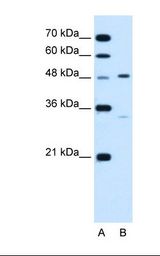 CHST1 Antibody - Lane A: Marker. Lane B: Jurkat cell lysate. Antibody concentration: 1.25 ug/ml. Gel concentration: 12%.  This image was taken for the unconjugated form of this product. Other forms have not been tested.