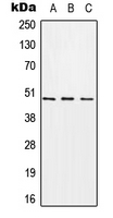 CHST1 Antibody - Western blot analysis of CHST1 expression in A549 (A); Raw264.7 (B); PC12 (C) whole cell lysates.