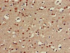 CHST1 Antibody - Immunohistochemistry of paraffin-embedded human brain tissue at dilution of 1:100