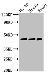 CHST1 Antibody - Western Blot Positive WB detected in:HL-60 whole cell lysate,Mouse brain tissue,Rat heart tissue All Lanes:CHST1 antibody at 3µg/ml Secondary Goat polyclonal to rabbit IgG at 1/50000 dilution Predicted band size: 47 KDa Observed band size: 47 KDa