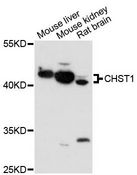 CHST1 Antibody - Western blot analysis of extracts of various cell lines, using CHST1 antibody at 1:1000 dilution. The secondary antibody used was an HRP Goat Anti-Rabbit IgG (H+L) at 1:10000 dilution. Lysates were loaded 25ug per lane and 3% nonfat dry milk in TBST was used for blocking. An ECL Kit was used for detection and the exposure time was 90s.