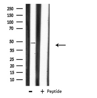 CHST1 Antibody - Western blot analysis of extracts of K562 cells using CHST1 antibody.