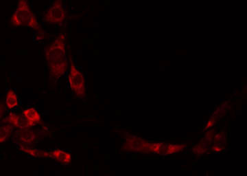 CHST1 Antibody - Staining HeLa cells by IF/ICC. The samples were fixed with PFA and permeabilized in 0.1% Triton X-100, then blocked in 10% serum for 45 min at 25°C. The primary antibody was diluted at 1:200 and incubated with the sample for 1 hour at 37°C. An Alexa Fluor 594 conjugated goat anti-rabbit IgG (H+L) Ab, diluted at 1/600, was used as the secondary antibody.