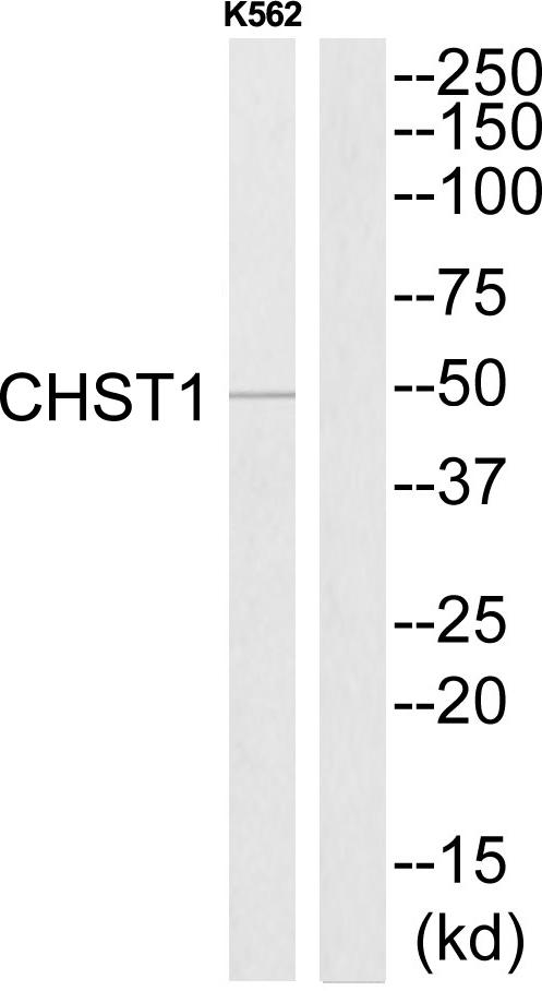 CHST1 Antibody - Western blot analysis of extracts from K562 cells, using CHST1 antibody.