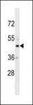 CHST10 Antibody - CHST10 Antibody western blot of HL-60 cell line lysates (35 ug/lane). The CHST10 antibody detected the CHST10 protein (arrow).