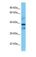 CHST10 Antibody - Western blot of CHST10 Antibody with Jurkat Whole Cell lysate.  This image was taken for the unconjugated form of this product. Other forms have not been tested.