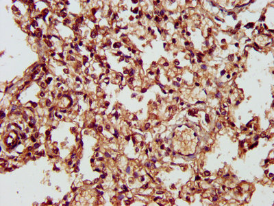 CHST11 Antibody - Immunohistochemistry image at a dilution of 1:300 and staining in paraffin-embedded human lung tissue performed on a Leica BondTM system. After dewaxing and hydration, antigen retrieval was mediated by high pressure in a citrate buffer (pH 6.0) . Section was blocked with 10% normal goat serum 30min at RT. Then primary antibody (1% BSA) was incubated at 4 °C overnight. The primary is detected by a biotinylated secondary antibody and visualized using an HRP conjugated SP system.