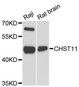 CHST11 Antibody - Western blot analysis of extracts of various cell lines, using CHST11 antibody at 1:3000 dilution. The secondary antibody used was an HRP Goat Anti-Rabbit IgG (H+L) at 1:10000 dilution. Lysates were loaded 25ug per lane and 3% nonfat dry milk in TBST was used for blocking. An ECL Kit was used for detection and the exposure time was 90s.