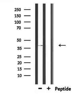 CHST11 Antibody - Western blot analysis of extracts of rat spleen using CHST11 antibody.