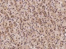 CHST12 Antibody - Immunochemical staining of human CHST12 in human adrenal gland with rabbit polyclonal antibody at 1:100 dilution, formalin-fixed paraffin embedded sections.