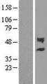 CHST12 Protein - Western validation with an anti-DDK antibody * L: Control HEK293 lysate R: Over-expression lysate