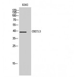 CHST13 Antibody - Western blot of CHST13 antibody