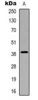 CHST13 Antibody - Western blot analysis of CHST13 expression in HepG2 (A) whole cell lysates.