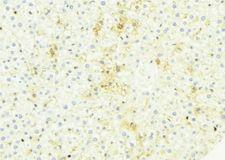 CHST13 Antibody - 1:100 staining mouse liver tissue by IHC-P. The sample was formaldehyde fixed and a heat mediated antigen retrieval step in citrate buffer was performed. The sample was then blocked and incubated with the antibody for 1.5 hours at 22°C. An HRP conjugated goat anti-rabbit antibody was used as the secondary.