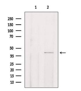 CHST13 Antibody - Western blot analysis of extracts of rat brain tissue using CHST13 antibody. Lane 1 was treated with the blocking peptide.