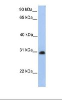 CHST14 Antibody - HepG2 cell lysate. Antibody concentration: 1.0 ug/ml. Gel concentration: 12%.  This image was taken for the unconjugated form of this product. Other forms have not been tested.