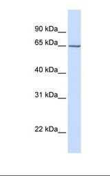 CHST15 Antibody - Hela cell lysate. Antibody concentration: 1.0 ug/ml. Gel concentration: 12%.  This image was taken for the unconjugated form of this product. Other forms have not been tested.