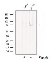 CHST15 Antibody - Western blot analysis of extracts of Jurkat cells using CHST15 antibody. The lane on the left was treated with blocking peptide.