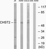 CHST2 Antibody - Western blot analysis of lysates from A549, COLO, and Jurkat cells, using CHST2 Antibody. The lane on the right is blocked with the synthesized peptide.