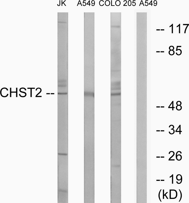 CHST2 Antibody - Western blot analysis of lysates from A549, COLO, and Jurkat cells, using CHST2 Antibody. The lane on the right is blocked with the synthesized peptide.