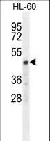 CHST2 Antibody - CHST2 Antibody western blot of HL-60 cell line lysates (35 ug/lane). The CHST2 antibody detected the CHST2 protein (arrow).