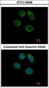 CHST2 Antibody - Immunofluorescence of methanol-fixed MCF-7, using CHST2 antibody at 1:500 dilution.