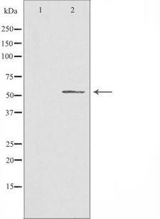 CHST2 Antibody - Western blot analysis of extracts of Jurkat cells using CHST2 antibody. The lane on the left is treated with the antigen-specific peptide.