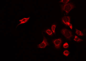CHST2 Antibody - Staining A549 cells by IF/ICC. The samples were fixed with PFA and permeabilized in 0.1% Triton X-100, then blocked in 10% serum for 45 min at 25°C. The primary antibody was diluted at 1:200 and incubated with the sample for 1 hour at 37°C. An Alexa Fluor 594 conjugated goat anti-rabbit IgG (H+L) Ab, diluted at 1/600, was used as the secondary antibody.
