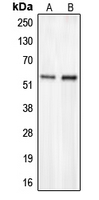 CHST2 Antibody - Western blot analysis of CHST2 expression in HepG2 (A); COLO205 (B) whole cell lysates.