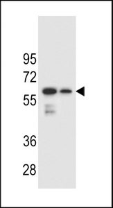 CHST3 Antibody - CHST3 Antibody western blot of mouse spleen and lung tissue lysates (35 ug/lane). The CHST3 antibody detected the CHST3 protein (arrow).