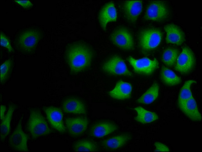 CHST3 Antibody - Immunofluorescence staining of A549 cells diluted at 1:100, counter-stained with DAPI. The cells were fixed in 4% formaldehyde, permeabilized using 0.2% Triton X-100 and blocked in 10% normal Goat Serum. The cells were then incubated with the antibody overnight at 4°C.The Secondary antibody was Alexa Fluor 488-congugated AffiniPure Goat Anti-Rabbit IgG (H+L).