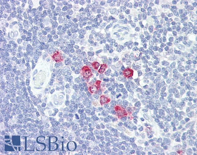 CHST4 / GlcNAc6ST2 Antibody - Anti-GlcNAc6ST2 / CHST4 antibody IHC of human thymus. Immunohistochemistry of formalin-fixed, paraffin-embedded tissue after heat-induced antigen retrieval. Antibody dilution 5-10 ug/ml. This image was taken for the unconjugated form of this product. Other forms have not been tested.