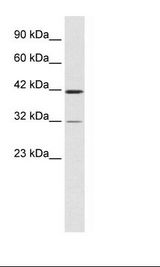 CHST4 / GlcNAc6ST2 Antibody - HepG2 Cell Lysate.  This image was taken for the unconjugated form of this product. Other forms have not been tested.