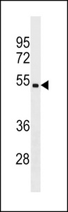 CHST5 Antibody - CHST5 Antibody western blot of ZR-75-1 cell line lysates (35 ug/lane). The CHST5 antibody detected the CHST5 protein (arrow).