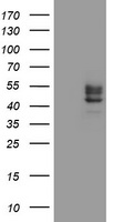 CHST6 Antibody - HEK293T cells were transfected with the pCMV6-ENTRY control (Left lane) or pCMV6-ENTRY CHST6 (Right lane) cDNA for 48 hrs and lysed. Equivalent amounts of cell lysates (5 ug per lane) were separated by SDS-PAGE and immunoblotted with anti-CHST6.
