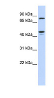 CHST6 Antibody - CHST6 antibody Western blot of Jurkat lysate. This image was taken for the unconjugated form of this product. Other forms have not been tested.