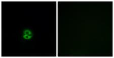 CHST6 Antibody - Immunofluorescence analysis of A549 cells, using CHST6 Antibody. The picture on the right is blocked with the synthesized peptide.