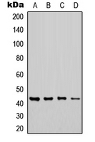 CHST6 Antibody - Western blot analysis of CHST6 expression in MCF7 (A); Jurkat (B); NS-1 (C); H9C2 (D) whole cell lysates.