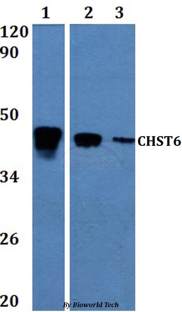 CHST6 Antibody - Western blot of CHST6 antibody at 1:500. Lane 1: MCF-7 whole cell lysate. Lane 2: H9C2 whole cell lysate. Lane 3: sp20 whole cell lysate.