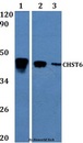 CHST6 Antibody - Western blot of CHST6 antibody at 1:500. Lane 1: MCF-7 whole cell lysate. Lane 2: H9C2 whole cell lysate. Lane 3: sp20 whole cell lysate.