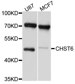 CHST6 Antibody - Western blot analysis of extracts of various cell lines, using CHST6 antibody at 1:1000 dilution. The secondary antibody used was an HRP Goat Anti-Rabbit IgG (H+L) at 1:10000 dilution. Lysates were loaded 25ug per lane and 3% nonfat dry milk in TBST was used for blocking. An ECL Kit was used for detection and the exposure time was 10s.