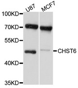CHST6 Antibody - Western blot analysis of extracts of various cell lines, using CHST6 antibody at 1:1000 dilution. The secondary antibody used was an HRP Goat Anti-Rabbit IgG (H+L) at 1:10000 dilution. Lysates were loaded 25ug per lane and 3% nonfat dry milk in TBST was used for blocking. An ECL Kit was used for detection and the exposure time was 10s.