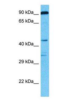 CHSY1 Antibody - Western blot of CHSS1 Antibody with human 786-0 Whole Cell lysate.  This image was taken for the unconjugated form of this product. Other forms have not been tested.
