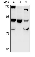 CHSY1 Antibody - Western blot analysis of CHSY1 expression in HEK293T (A), PC12 (B), AML12 (C) whole cell lysates.