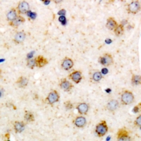 CHSY1 Antibody - Immunohistochemical analysis of CHSY1 staining in human brain formalin fixed paraffin embedded tissue section. The section was pre-treated using heat mediated antigen retrieval with sodium citrate buffer (pH 6.0). The section was then incubated with the antibody at room temperature and detected using an HRP conjugated compact polymer system. DAB was used as the chromogen. The section was then counterstained with haematoxylin and mounted with DPX.